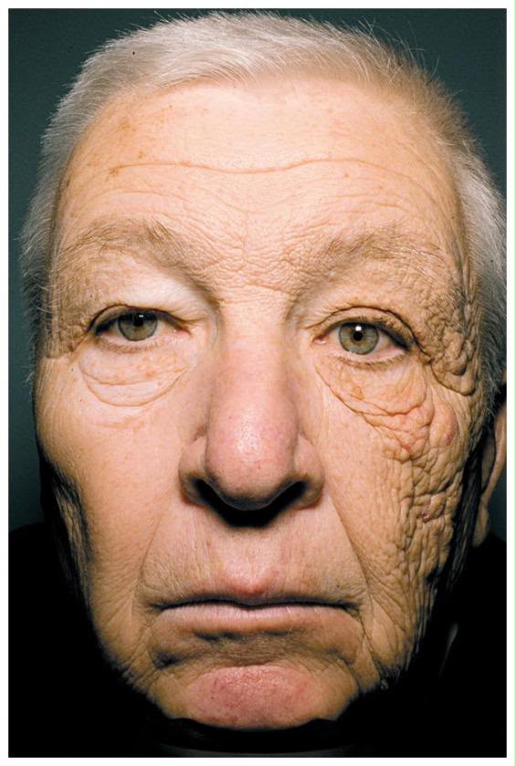 Do We Really Need To Wear Sunscreen? The Answer May Surprise You.