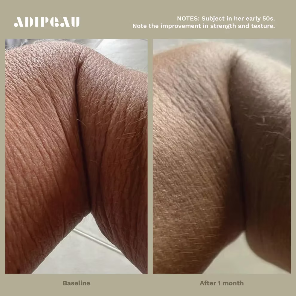 Adipeau Strong Body Gel