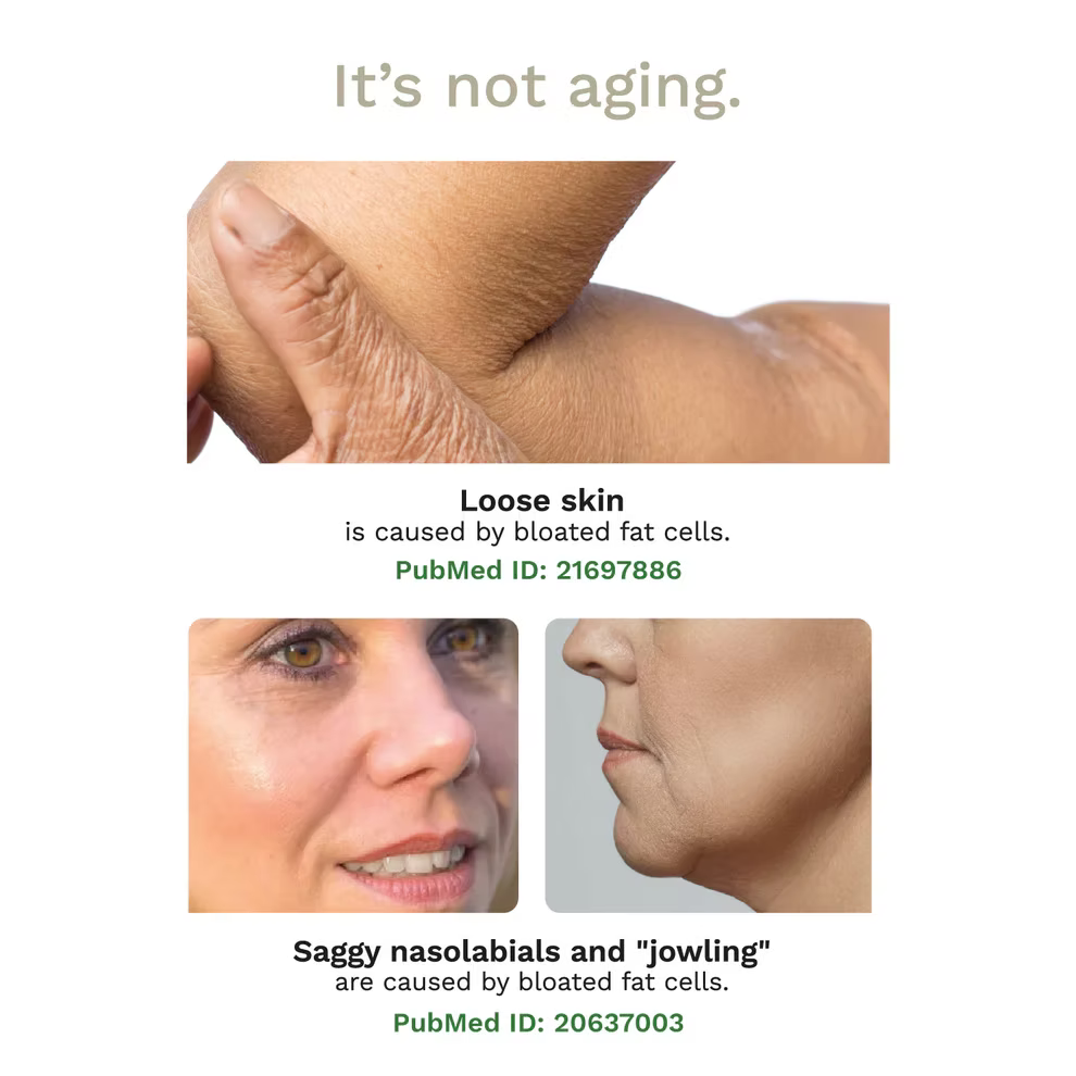 Adipeau Strong Body Gel