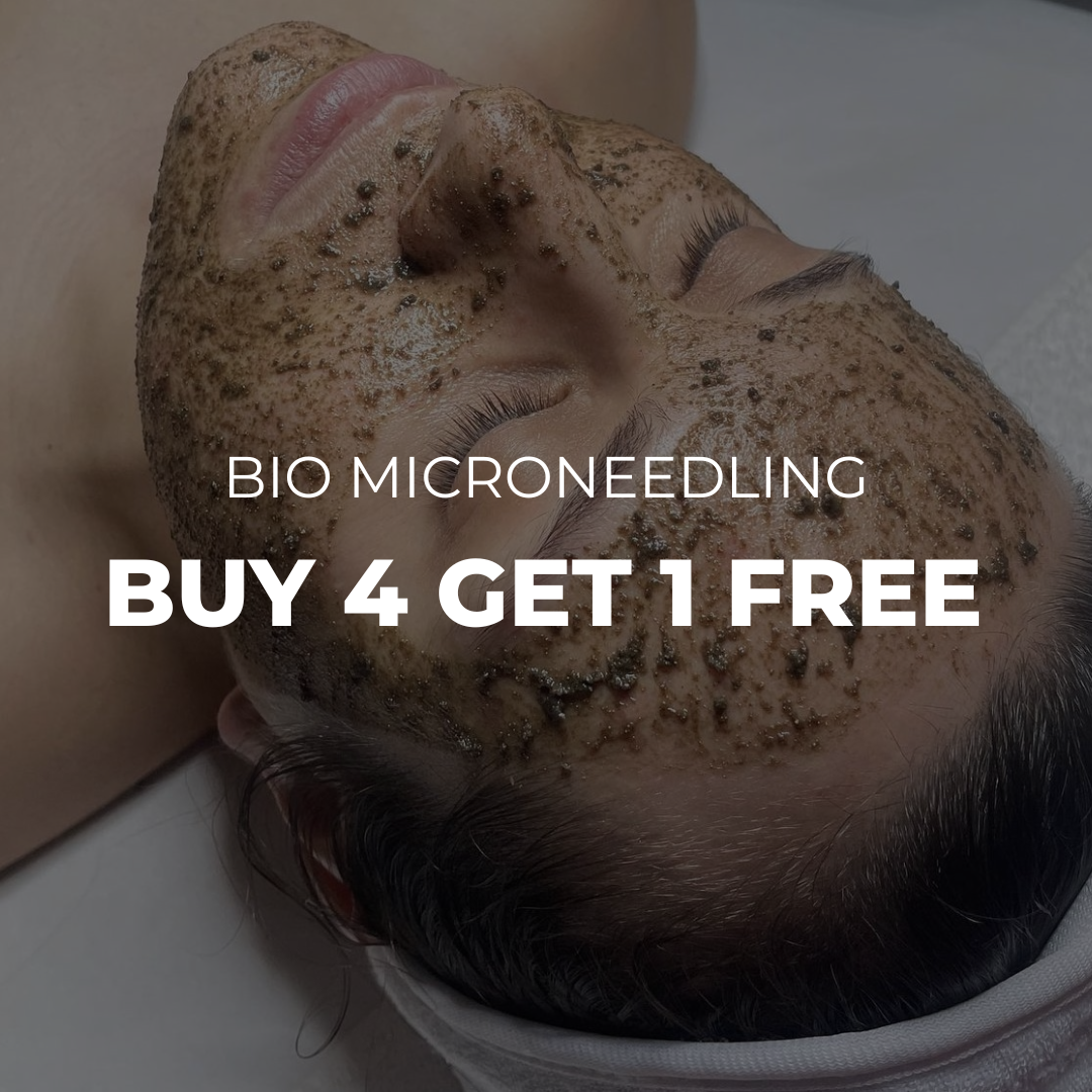 BioMicroneedling - Buy 4 Get 5th Free