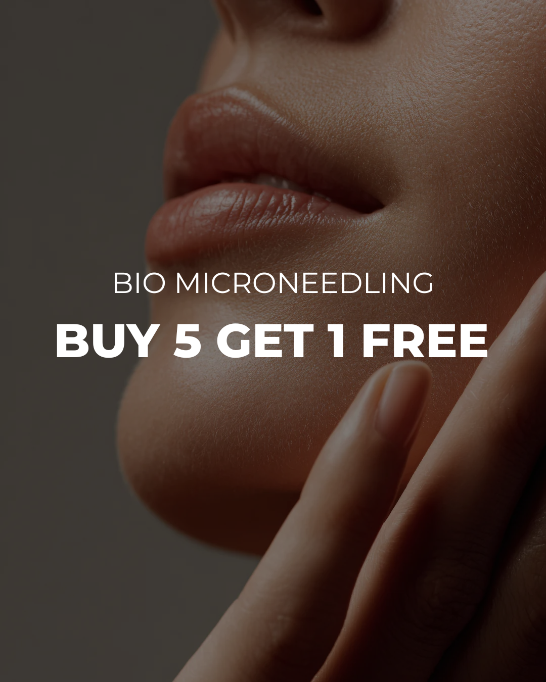 Bio Microneedling - Buy 5 Get 1 Free