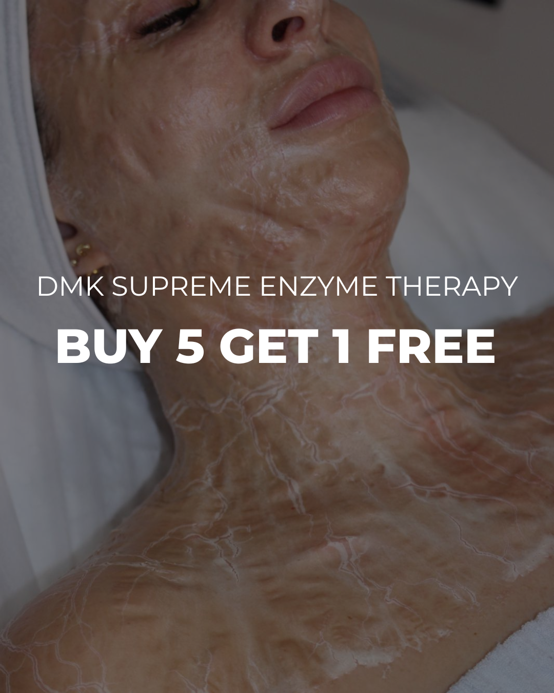 DMK Supreme Enzyme Therapy - Buy 5 Get 1 Free