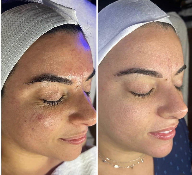 Before and after treatment result
