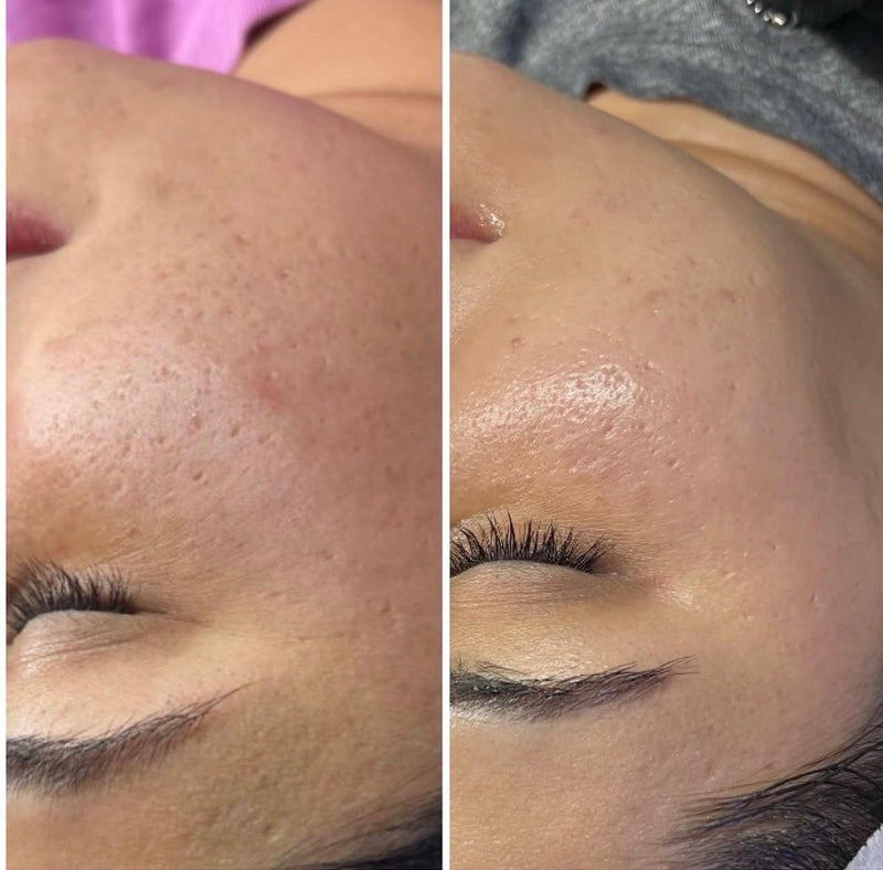 Before and after treatment result