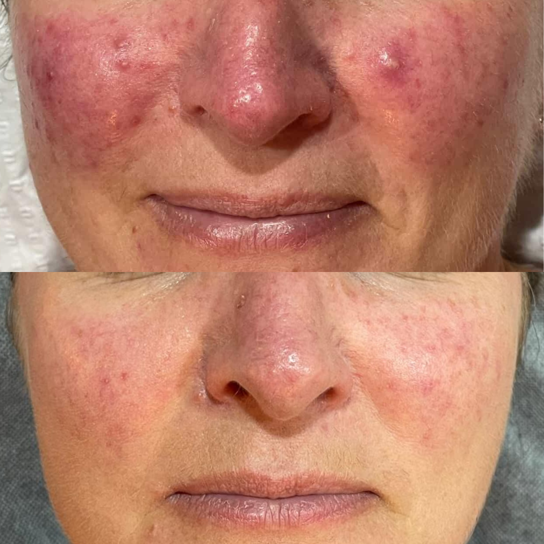 Before and after comparison of a person's face with a compromised barrier.